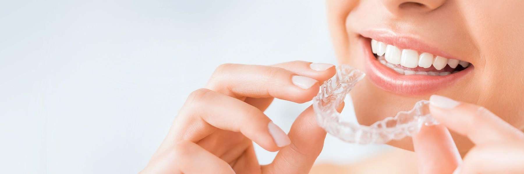 Invisalign Clear Aligners | Dentist